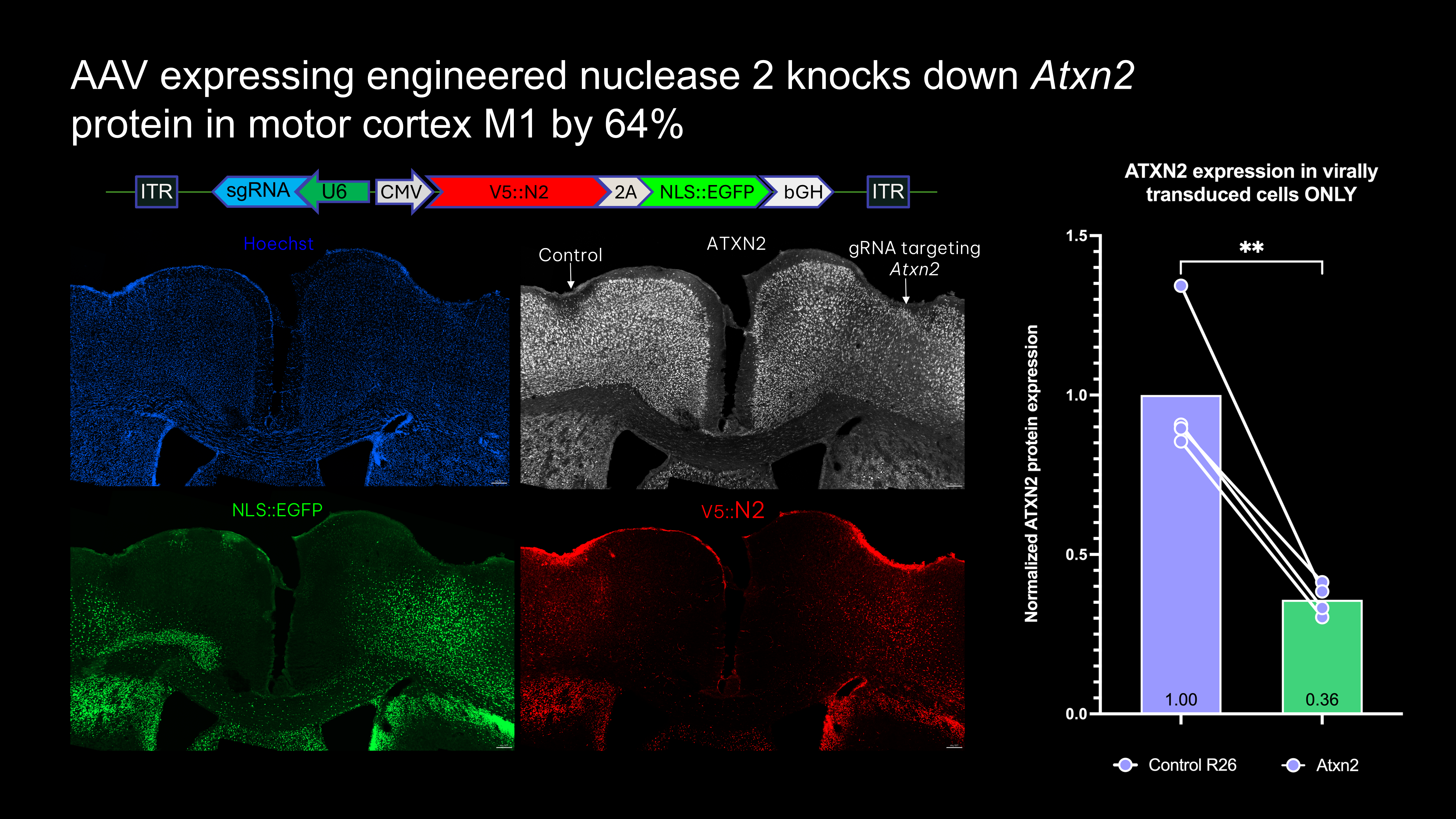 Dual injection coronal 2