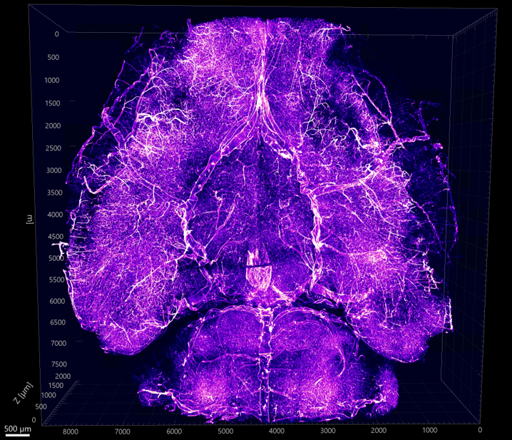 Cleared whole brain vasculature